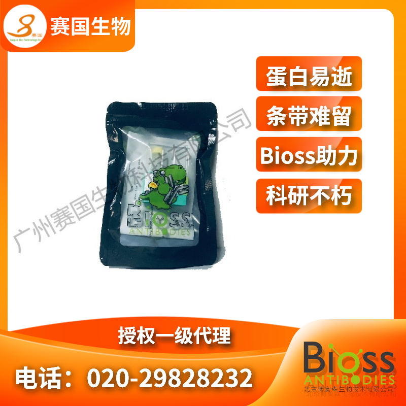 核心結(jié)合因子α1/成骨特異性轉(zhuǎn)錄因子/Cbfα1抗體  |  RabbitAnti-RUNX2 antibody